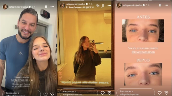 Rafa Justus celebra resultado de nova rinoplastia e dispara sobre mudança: ‘Eu tinha muito problema…’ 34 gnDHhP8RDKLUmc2XTVQ2q4WUiF0WRnnWXsYBb0PX