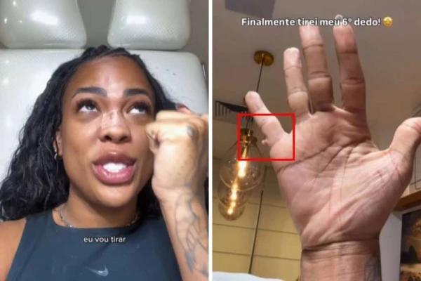 Cantora Marvvila passa por cirurgia na mão e retira dedo 34 WU4jlFYUtBuUWRD5taCZXmHQuWPfdV7vftUyIbuu