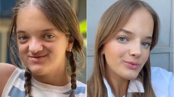 Rafaella Justus chama a atenção ao surgir em foto e mudanças no nariz após cirurgia vêm à tona 34