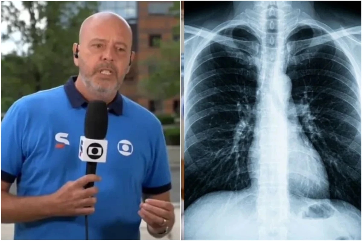 Estes são os sintomas do tumor diagnosticado em Alex Escobar
