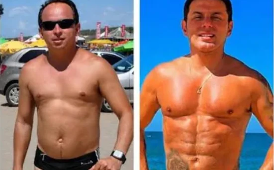 Marido de Gretchen passa por lipo HD e transplante capilar, e cantor chama atenção ao revelar visual atual 34