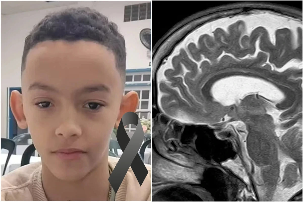 Menino morre após bolada na cabeça em escola e caso acende alerta; ficar atento aos sinais é fundamental