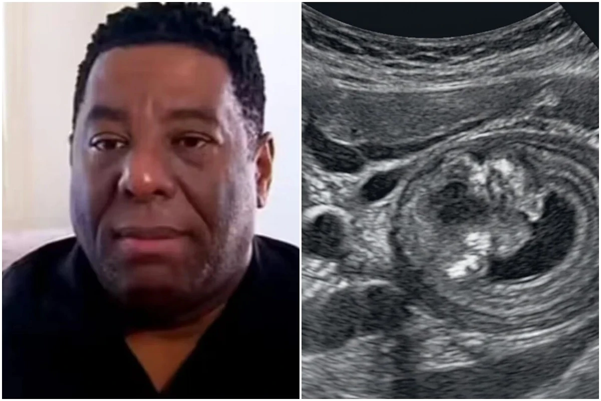 Este é o câncer diagnosticado em Netinho de Paula; decisões precisaram ser tomadas
